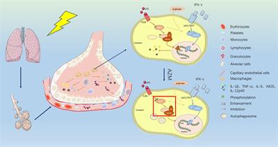 Immunomodulatory role of azithromycin: Potential applications to radiation-induced lung injury